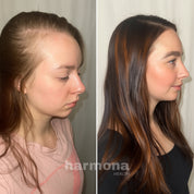 Aurora Brush for Hair Growth & Scalp Care